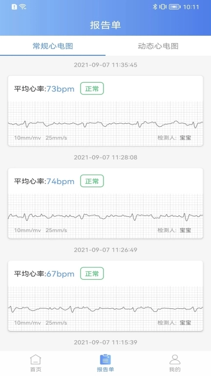 卡帕奇心电
