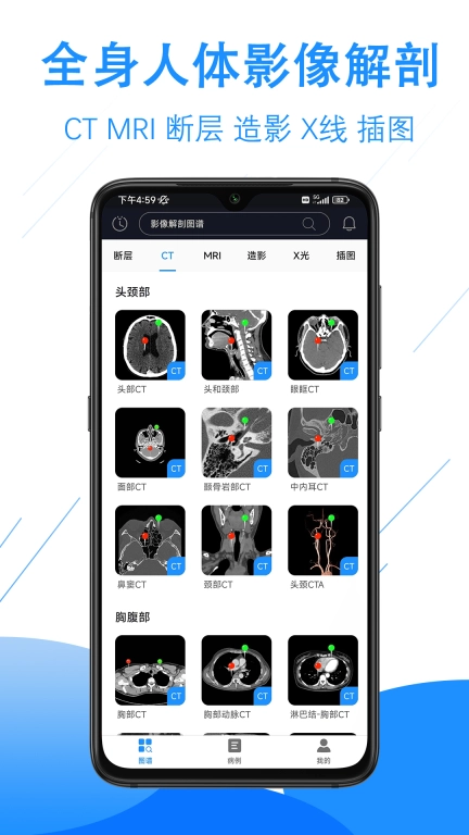 影像解剖图谱