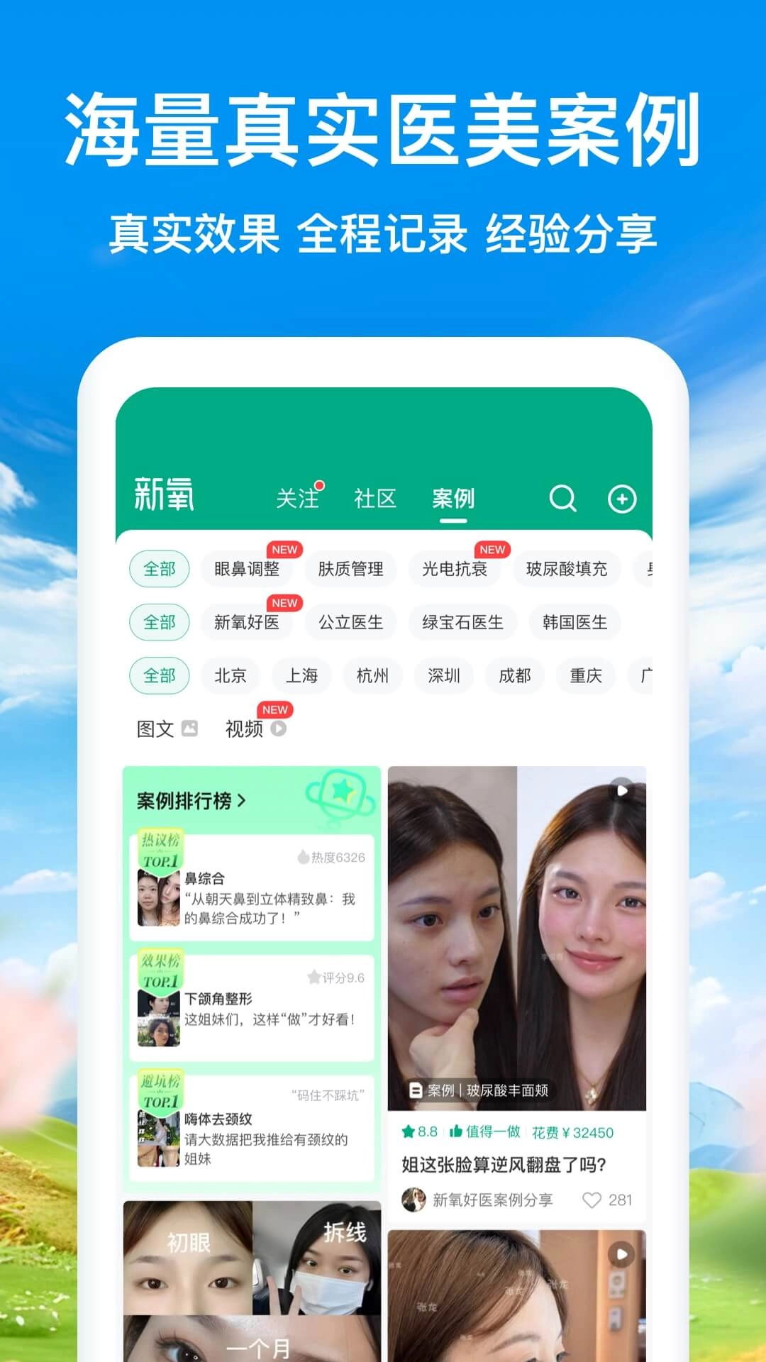 新氧极速版