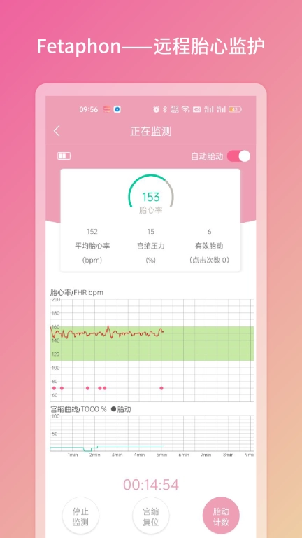 Fetaphon Home-智能母婴安全监护