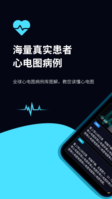 心电图ECG-全球心电图病例库图解