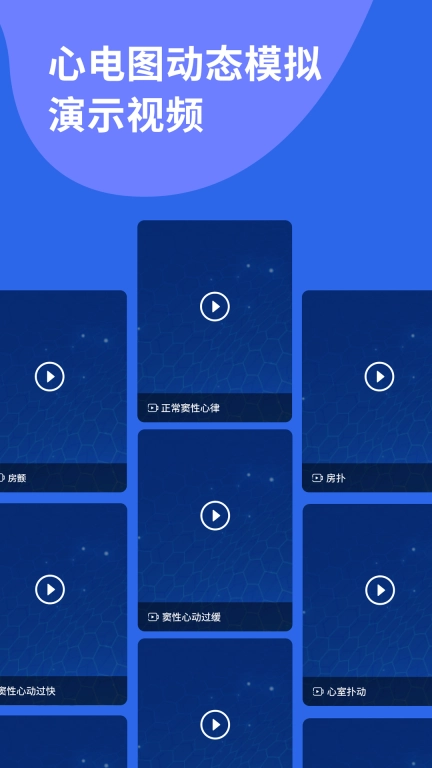 心电图ECG-全球心电图病例库图解