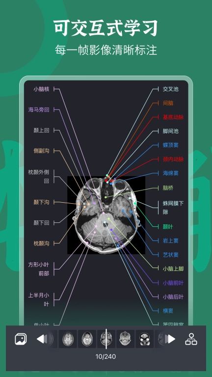 万康人体解剖-3D解剖