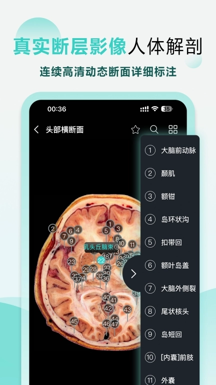 掌上3D解剖-中医断层刷题名师课