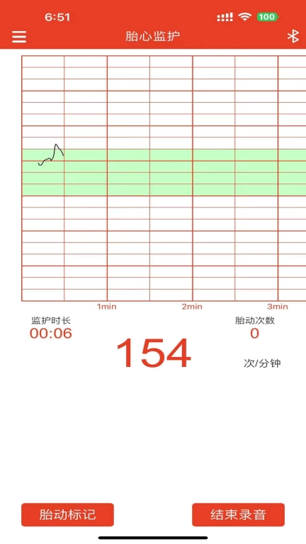 左点胎心仪