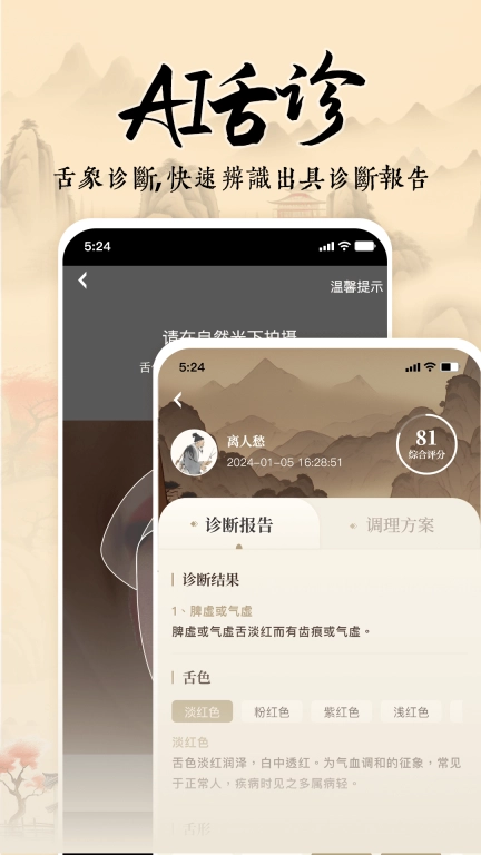 针灸穴位图解-经络穴位图解