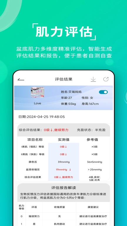 左点盆底肌
