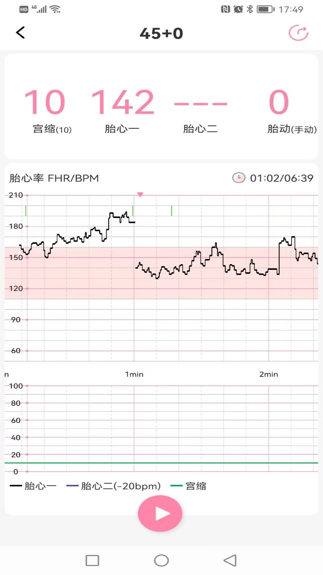 十月宝贝孕妇版