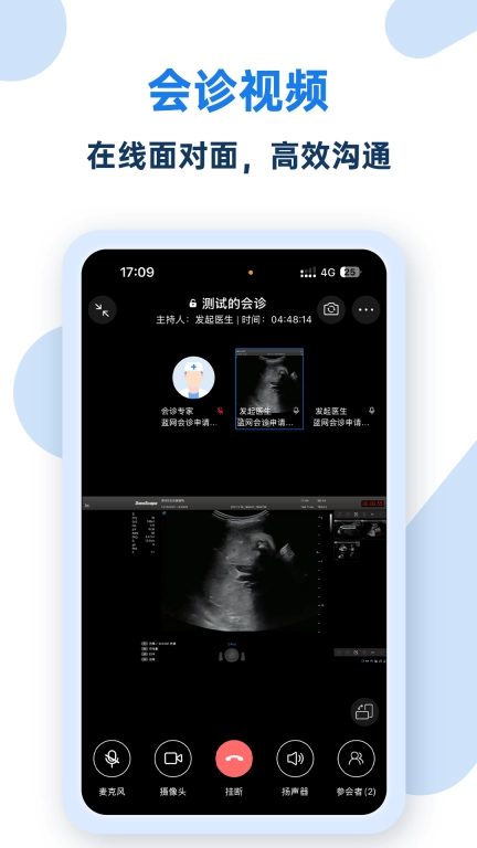 掌中影