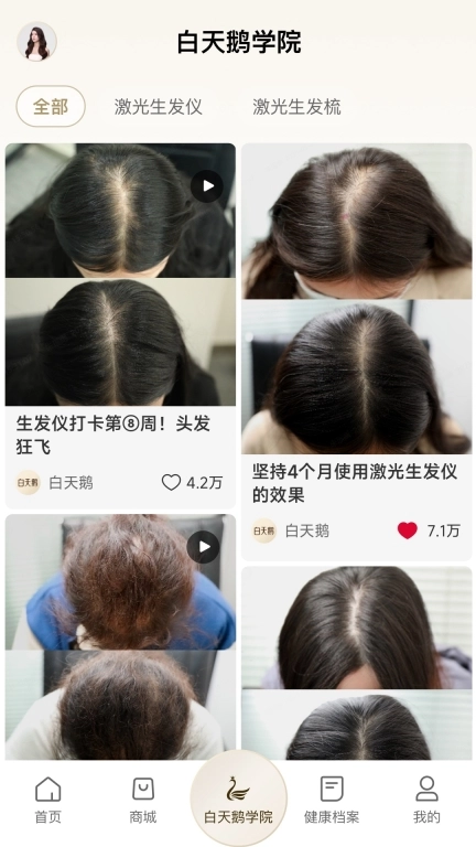 白天鹅