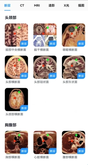影像解剖图谱手机下载