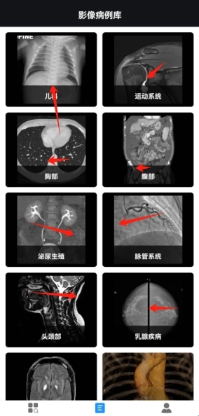影像解剖图谱手机下载