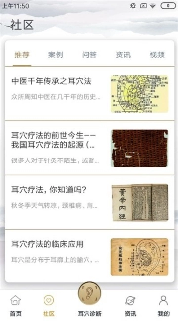 晓耳朵图1