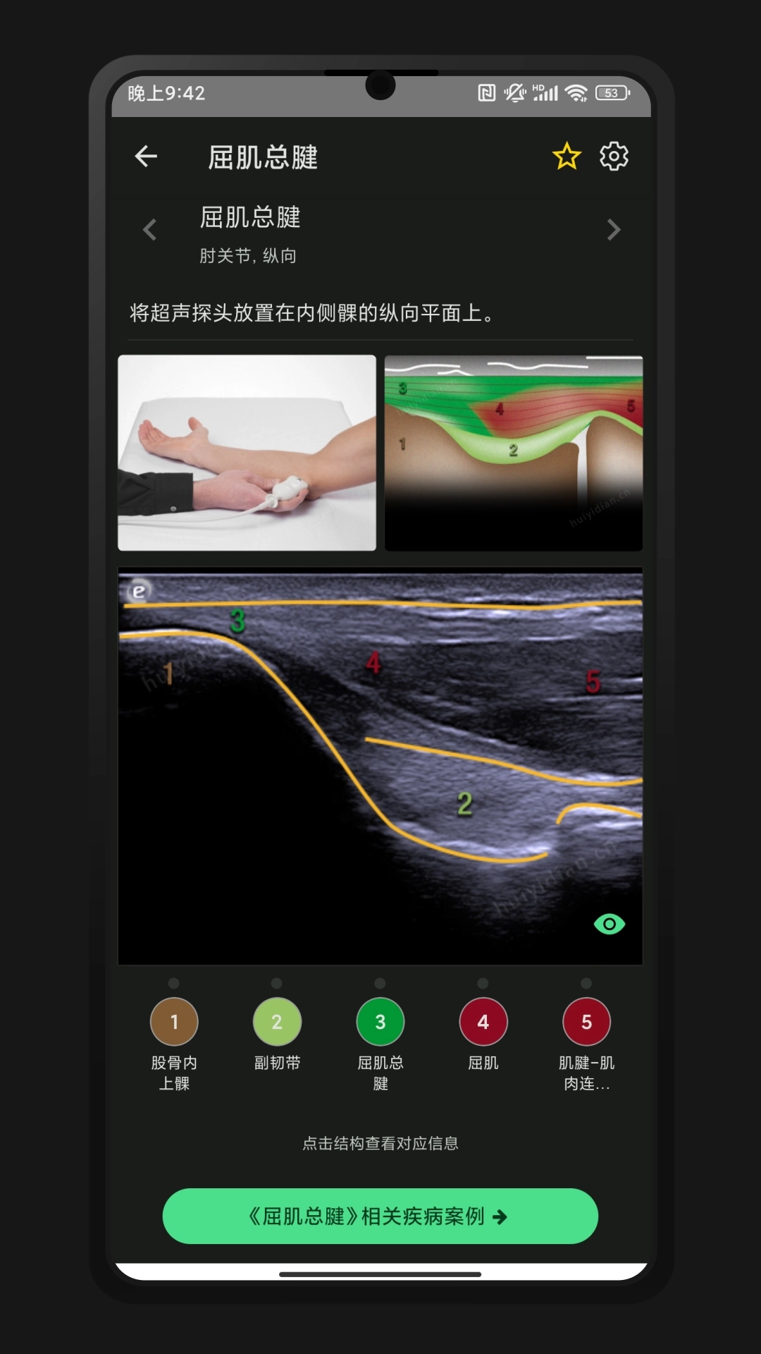 超声智学安卓版