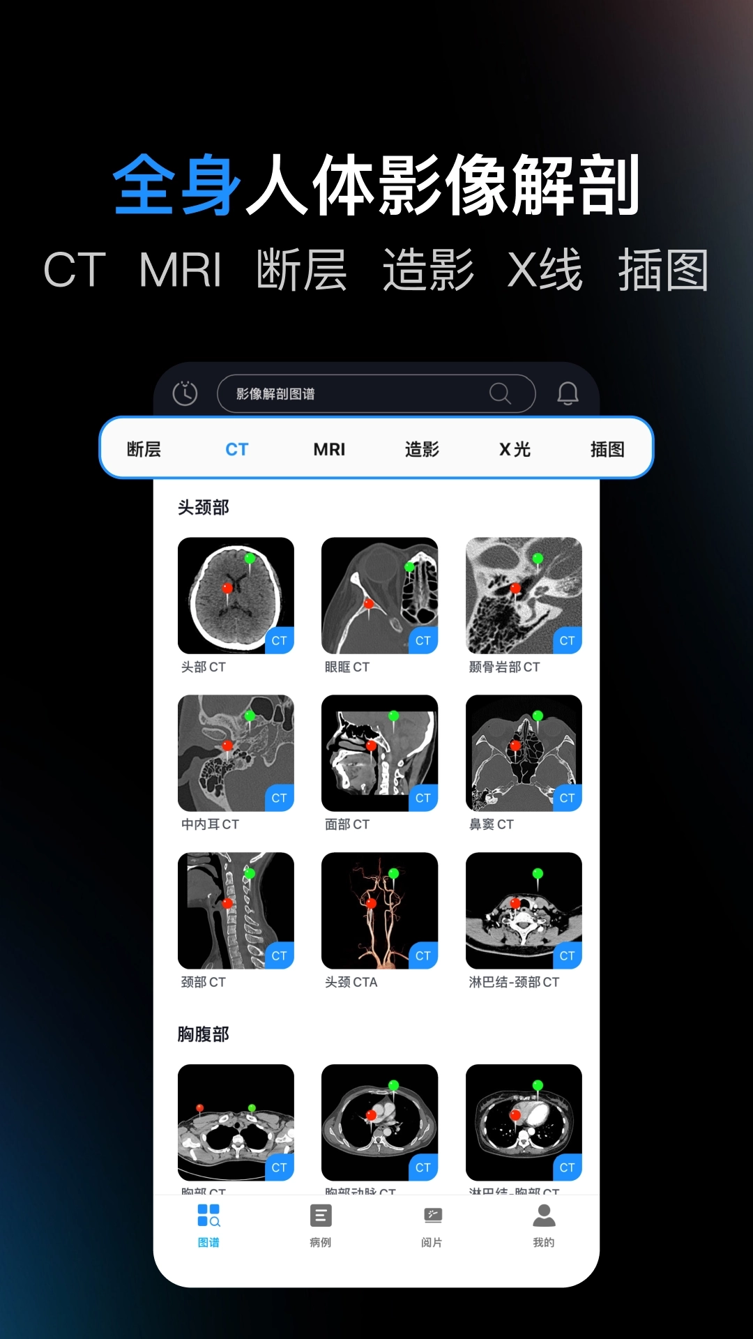 影像解剖图谱2