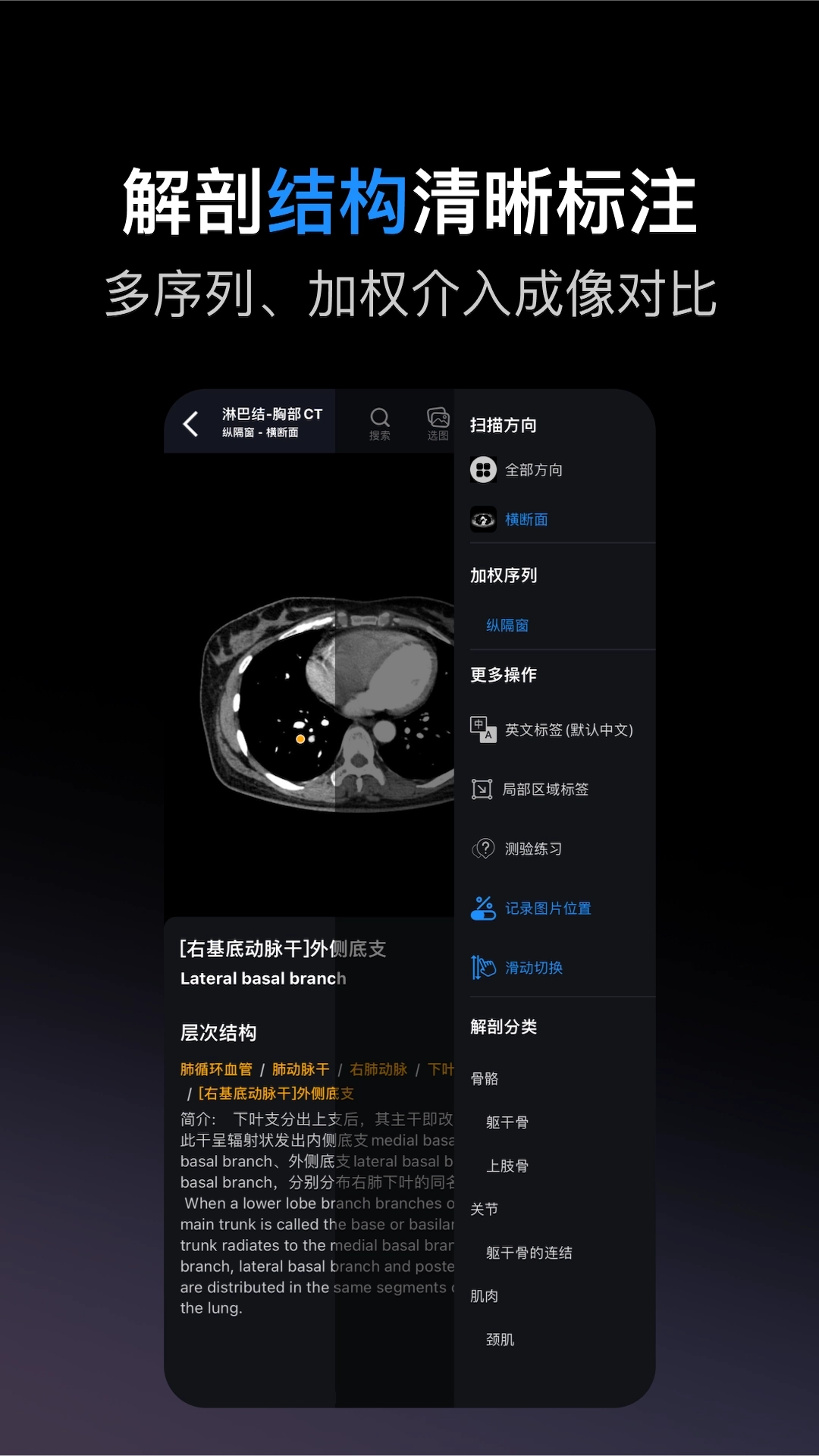 影像解剖图谱3