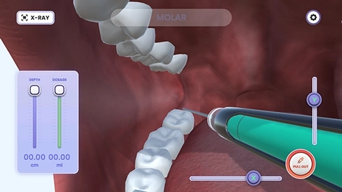 牙医模拟器游戏(DentistSimulation)3